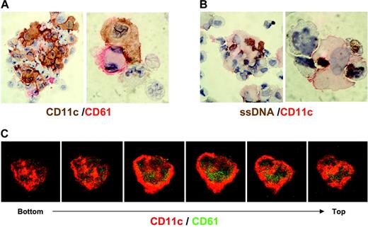 Figure 4. Physical association and phagocytosis of CD61+ cells by CD11c+ cells. Five days after culture with 100 ng/mL TPO and 2.5 ng/mL TNF-α, the cells were cytospun and stained with anti-CD11c (brown) and anti-CD61 (red) (A) or with anti-CD11c (red) and anti-ssDNA (brown) (B); original magnification, × 1000. (C) Cells placed on coverslips were fix-permeabilized, stained with FITC-CD61 (green) and PE-CD11c (red), and then were observed by laser scanning confocal microscopy. A serial 3-dimensional reconstruction of the cells demonstrates the phagocytosis of CD61+ cells (green) by CD11c+ cells (red).
