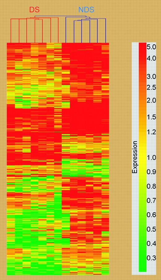 Cluster analysis of differentially expressed genes between DS and non-DS megakaryoblasts; chromosomal localization of genes in cluster analysis. See the complete figure in the article beginning on page 1570.