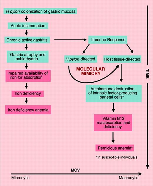 Proposed sequence of nutrient deficiency anemias caused by H pylori. Pernicious anemia occurs in individuals predisposed to autoimmune gastric atrophy.