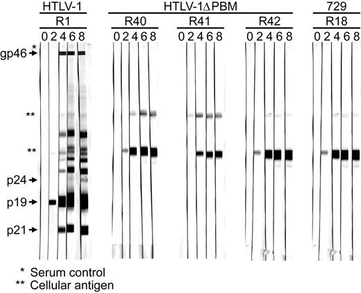 Figure 7. Assessment of HTLV-1 infection in inoculated rabbits. Rabbits were inoculated with approximately 1 × 107 irradiated 729HTLV-1, 729HTLV-1ΔPBM-infected cells, or uninfected control cells. At weeks 0, 2, 4, 6, and 8 after inoculation, rabbit PBMCs and sera were isolated from blood. HTLV-1–specific serologic response. Sera from inoculated rabbits were tested for reactivity to specific HTLV-1 proteins by Western blot. A representative rabbit from the positive wtHTLV-1–inoculated group (R1-R5) and negative control group (R18-R22), and 3 HTLV-1ΔPBM–inoculated rabbits (R40-R42) are shown. Viral proteins and 729 cell–specific proteins (**) are labeled on the left.