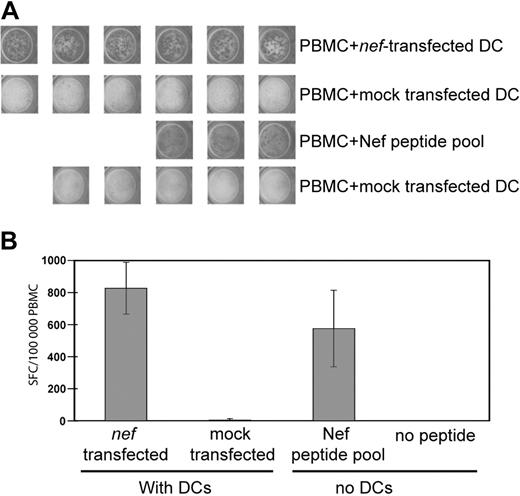 Figure 2. Transfected MDDCs stimulate PBMC T cells ex vivo. PBMCs from an HIV+ subject were incubated in an overnight IFNγ ELISpot assay with or without transfected autologous DCs. DCs were transfected with 10 μg/106 DCs of consensus nef mRNA or were mock transfected. PBMCs without DCs were incubated with or without a Nef peptide pool matched to the RNA sequence. Each well contained 100 000 PBMCs. The PBMC/DC ratio was 10:1. (A) Digital images of replicate ELISpot wells. (B) Mean response of wells shown in panel A counted with an automated plate reader. Error bars represent 1 standard deviation; SFC, spot-forming cells.