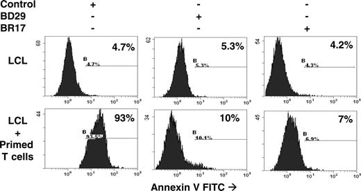 Figure 7. Induction of T-cell killing of EBV-immortalized LCL cells. A mixed lymphocyte reaction was performed by incubating T cells with their targets (LCL cells) in the presence (+) or absence (-) of the anti-CD95–neutralizing mAb BD29 or anti-CD95 ligand–neutralizing mAb BR17. Anti-CD95 BD29 mAb and anti-CD95 ligand BR17 mAb were preincubated for 15 minutes at room temperature with LCL cells or purified primed T cells, respectively, before coincubation of T cells with their targets. Control indicates LCL cells incubated with an irrelevant anti-NGFR antibody; LCL + primed T cells, LCL cells incubated with T cells primed against their target by coculture with the same LCL cells irradiated at 75 Gy for 5 days.