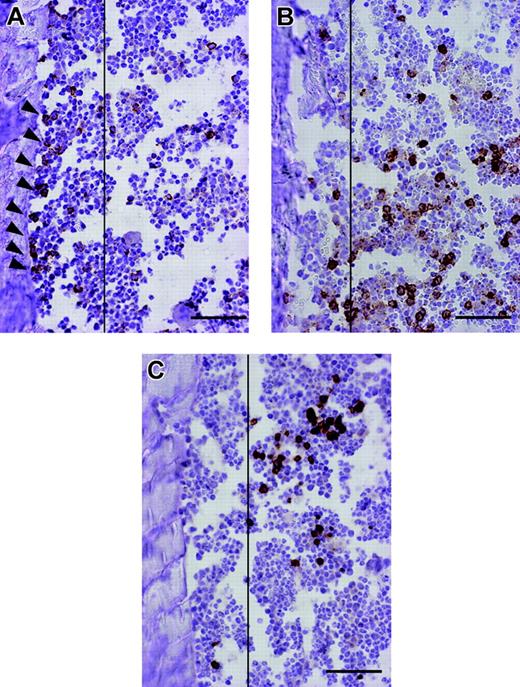Figure 1. Spatial distribution of human hematopoietic cells in the murine BM compartment. Representative pictures of bone specimens from NOD/SCID mice at 10 weeks after IBMT of 2 Ă— 105 CBCD34 cells are shown. Slides were stained with either anti-CD34, anti-CD15, or anti-glycophorin A antibody, and cells expressing the respective antigens were distinguished by brown reactive products of DAB on immunohistochemistry. CD34+ cells are localized to the endosteal region (A; black arrowheads), whereas CD15+ (B) and GlyA+ cells (C) are distributed away from the endosteum. Vertical lines demarcate 12 cells of the endosteum. Bars represent 100 ÎĽm. Images were obtained using an Olympus AX80 microscope and a 20 Ă—/0.7 NA UPlanApo objective lens. Images were captured using a DP50 digital camera fitted with Viewfinder Lite (all from Olympus, Tokyo, Japan).