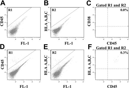 Figure 2. BM homing of purified ALDHhiCD133+Lin- or ALDHhiCD133-Lin- cells 48 hours after transplantation. Representative flow cytometric analysis of NOD/SCID β2M-null mice that received transplants of 2 × 105 purified (A-C) ALDHhiCD133-Lin- or (D-F) ALDHhiCD133+Lin- cells. At 48 hours after transplantation, human hematopoietic cells were detected in the murine BM by coexpression of CD45 (R1) and HLA A, B, and C (R2).