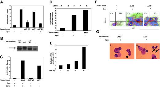 Figure 1. AKT complements EpoR signaling in inducing erythroid differentiation in wild-type and JAK2-/- fetal liver progenitor cells. TER 119- E14 wild-type (A) or JAK2-/- (C) fetal liver cells were transduced with a bicistronic retroviral vector (MIG) or MIG containing the indicated inserts and cultured in the presence or absence of Epo (2 U/mL) on RetroNectin. Thirty-six hours later, live GFP-positive cells from wild-type–(A) or JAK2-/--transduced cells (C) were assayed for CFU-E–generated colony content as determined by diaminobenzidine staining of hemoglobin. Graphs are from duplicates of 4 (A) and 3 (C) independent experiments. The average of the absolute number of CFU-E–derived colonies formed from vector control–transduced cells in the presence of Epo was 3160 ± 64 (n = 4) per 105 wild-type TER 119- cells and 1248 ± 263 per 105 JAK2-transduced JAK2-/-- (n = 3) plated cells. (B) Western blot analysis of transduced NIH 3T3 cells with 1:10 dilution of the retroviral supernatant. The upper band in the activated AKT*-transduced cells corresponds to the Flag-tagged myristylated AKT. (D) Real-time PCR analysis of the β-globin gene in live GFP-positive cells from panel A. Representative graph from duplicate analysis of 2 independent experiments. (E) Real-time PCR analysis of kinetics of up-regulation of β-globin gene expression in TER 119- E14 wild-type fetal liver–derived cells transduced with MIG-AKT* (results expressed as relative to time zero are from total cells). (F) JAK2-/- fetal liver–transduced cells with MIG, MIG-JAK2, or with a constitutively active AKT (MIG-AKT*) and cultured in the presence of Epo (MIG-JAK2 cells) or in the absence of Epo (vector control and MIG-AKT* cells) were analyzed for erythroid-cell differentiation 36 hours later (note TER 119+ cells within transduced GFP-positive cells). (G) Representative field of Wright-Giemsa staining of live GFP-positive transduced JAK2-/--derived cells (magnification, × 1000). Arrows show (i) polychromatophilic erythroblast and (ii) polychromatophilic erythroblast and normoblast. Images were obtained using a Nikon Eclipse E600 microscope (Nikon, Garden City, NJ) and a 100 ×/0.3 numeric aperture oil immersion lens. Images were captured using an RT Slider SPOT 2.3.1 camera and SPOT Advanced software (both from Diagnostic Instruments, Sterling Heights, MI).