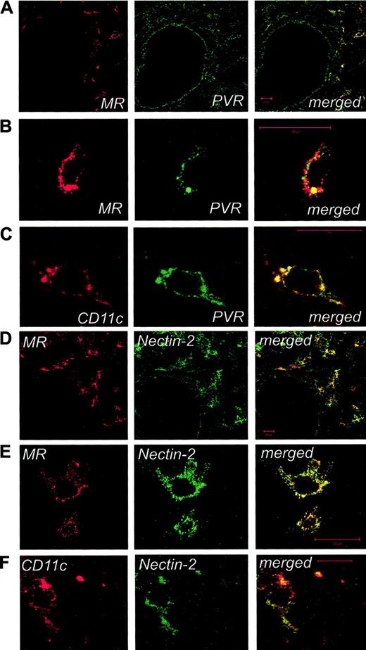 Figure 6. Laser confocal microscopy characterization of PVR- and Nectin-2-expressing cells in human lymph nodes. Human lymph nodes were stained for mannose receptor (MR; red) and PVR (A) or Nectin-2 (D; green) and were analyzed by confocal microscopy. Cells around the HEV show colocalization of DNAM-1 ligands and MR (merged images, yellow), whereas single staining for DNAM-1 ligands is visible on endothelial cells. High-power magnifications focused on single cells around the HEVs show costaining of MR and CD11c markers with PVR (B-C) and Nectin-2 (E-F). No staining was observed by using an isotype-matched control mAb with irrelevant specificity (not shown). Bar indicates 20 μm. Images in panels A-E were acquired using an LSM 510 Meta confocal microscope (Zeiss, Jena, Germany) equipped with a 40 ×/1.30 NA oil Plan-Neofluor objective lens (Zeiss). Images in panel F were acquired using an LSM 510 Meta laser scanning confocal microscope equipped with a 63 ×/1.4 NA oil Plan-Neofluor objective lens (Zeiss). LSM 510 Meta confocal microscope software version 3.0 (Zeiss) was used to capture all the images.