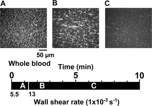 Figure 1. Activation-independent and shear rate-dependent aggregation and disaggregation of platelets perfused over immobilized VWF. Whole blood containing 93 μM PPACK as the anticoagulant, 10 μM PG E1 to block platelet activation, and 10 μM mepacrine to render platelets fluorescent for visualization, was perfused over a surface coated with immobilized VWF. The images shown are single frames from a real-time recording (Video S1). A timeline (black horizontal bar) indicates at what moment during the perfusion experiment a given image was taken, as shown by the position of the corresponding letter (A, 55 seconds; B, 130 seconds; and C, 380 seconds).Avertical white bar separates the timeline in segments corresponding to periods of perfusion at different wall shear rates (5500 or 13 000 s-1). The images are representative of 3 separate experiments performed with blood from different donors.
