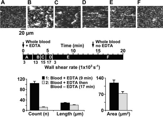 Figure 2. Effect of EDTA on the activation-independent and shear rate–dependent aggregation and disaggregation of platelets perfused over immobilized VWF. Whole blood containing 93 μM PPACK, 10 μM PG E1, 10 μM mepacrine, and the addition of EDTA (5 mM) from the beginning of flow, was perfused over immobilized VWF at varying wall shear rates. The images shown are single frames from a real-time recording (Video S2). The timeline (black horizontal bar) shows at what moment during the experiment a given image was taken as well as the wall shear rate during different periods of perfusion, as explained in the legend to Figure 1 (A, 50 seconds, 3000 s-1; B, 180 seconds, 13 000 s-1; C, 240 seconds, 15 000 s-1; D, 340 seconds, 17 000 s-1; E, 540 seconds, 3000 s-1; and F, 1020 seconds, 3000 s-1). An arrow at 14 minutes on the timeline indicates when blood without EDTA replaced the blood with EDTA (from the same donor) perfused from the beginning of the experiment. The bar graph shows the average count, length, and area of all the platelet aggregates present in 5 different positions on the surface after 540 seconds (▪) and 1020 seconds (▦) of perfusion under the conditions described. All values are reported as mean ± SEM and differences are statistically significant (count: P < .001; length: P < .001; area: P < .006).
