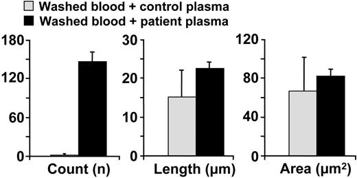 Figure 5. Effect of plasma from a congenital TTP patient on VWF-mediated and activation-independent platelet thrombus formation under flow. Normal washed blood cells were resuspended either in the plasma of a healthy individual (control plasma) or that of a patient with TTP obtained from therapeutic plasmapheresis (patient plasma). The bar graph shows the average count, length, and area (mean ± SEM) of all the platelet aggregates present in 5 separate fields of view measured after a 10-minute perfusion. Only the difference in aggregate count was significant (P < .001).