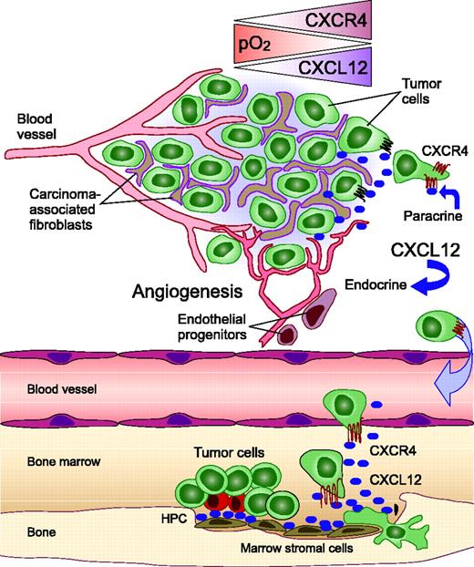 Figure 2. Importance of the CXCR4 chemokine receptor and its ligand, CXCL12, in the tumor microenvironment and for targeted metastasis. Within hypoxic areas of tumors, both CXCL12 expression by fibroblasts and CXCR4 expression on tumor cells increases, which stimulates tumor cell motility and invasiveness. Carcinoma-associated fibroblasts (CAFs), but not normal fibroblasts, stimulate tumor progression by CXCL12 secretion. Two major mechanisms by which fibroblast-derived CXCL12 promotes tumor genesis have been identified. First, CXCL12 promotes tumor cell growth in a paracrine fashion by directly stimulating tumor cell growth via CXCR4. Second, CXCL12 from CAFs induces recruitment of endothelial progenitors, which allow for tumor angiogenesis (endocrine effect of CXCL12). Targeted metastasis to the marrow or other sites of high CXCL12 expression involves CXCR4 activation on circulating tumor cells that “hijack” the CXCR4-CXCL12 axis for homing to microenvironments that normally are restricted to hematopoietic progenitor cells (HPCs). CXCL12 gradients attract CXCR4-positive tumor cells to marrow niches where marrow stromal cells secrete high levels of CXCL12. As a consequence, tumor cells can displace HPCs from their protective microenvironment, resulting in hematopoietic dysfunction. Moreover, tumor cells may invade adjacent tissues, resulting in bone destruction.