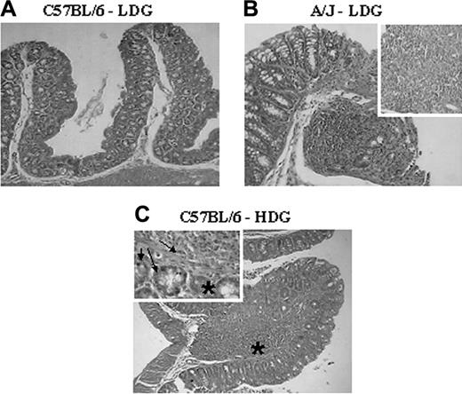Figure 5. Inhibition of GVHD by granulocytes requires activation and histocompatibility. Irradiated (C57BL/6 × BALB/c) F1 receptors mice received BMTD and T cells from C57BL/6 mice plus LDGs from C57BL/6 mice (A), allogeneic third-party LDGs from A/J mice (B), or non–G-CSF–treated HDGs from C57BL/6 mice (C). After 22 days the animals were killed and the intestines were submitted to histopathologic analysis. Intense inflammatory foci in lamina propria is observed in A/J LDGs (B) and HDGs recipient (C) with mononuclear cells (B, inset) and mixed inflammatory infiltrate (*C, inset) associated with crypt cell apoptosis (arrows). Original magnifications, 40 × (A-C); 400 × (B, inset); 1000 × (C, inset). Results are representative of 1 of 5 experiments.