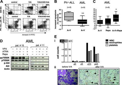 Figure 2. VPA/ATRA treatment efficacy in primary leukemia cells in vitro and in vivo. (A) VPA/ATRA-induced apoptosis in BCR/ABL positive leukemia is caspase-dependent. 32D-BCR/ABL cells (top row) and a Ph+-ALL patient sample no. 9 (bottom row) were treated with VPA/ATRA (A+V), VPA/ATRA plus the pan-caspase inhibitor z-VAD-fmk, (A+V+ z-VAD-fmk), or mock-treated (control). Forty-eight hours after start of exposure to these compounds, apoptosis was assessed using FITC-Annexin/propidium iodide staining and fluoresecence activated cell-scanning (FACS) analysis. The total percentage of apoptotic cells is shown in the right quadrants, respectively. A representative experiment of at least 3 independent experiments for the 32D-BCR/ABL cell line and the patient sample is shown. Box-and-whisker plots for the comparison of VPA/ATRA (A+V)–mediated apoptosis in Ph+ ALL versus AML blasts in vitro (B) and the effect of VPA/ATRA (A+V), rapamycin (Rapa), or both (A+V+rapa) on apoptosis induction in primary AML (C). Lines in boxes indicate the median; boxes display data points located in the middle 2 quartiles of all data points. Whiskers extend to the 2 extreme values of all data points. Significant differences of medians of apoptosis induction, as determined by Mann-Whitney U-test, are indicated (**P < .01; *P < .03). (D) Western blotting of protein lysates generated from representative AML samples (patients no. 15 and no. 11) after in vitro treatment with indicated compounds for 48 hours. (E) A Ph+ ALL patient was treated with VPA/ATRA. Changes in peripheral white blood counts, percentage of granulocytes in the peripheral blood, and platelets are depicted during the first 45 days of treatment (i). Hypercellular bone marrow aspiration showing a homogenous ALL-blast infiltrate before treatment (ii, left panel), and bone marrow histology obtained after induction of remission with VPA/ATRA (ii, middle and right panels). Note the rare infiltration with CD34+/TdT+ ALL blasts in a hypocellular marrow (arrows in ii, middle and right panels).