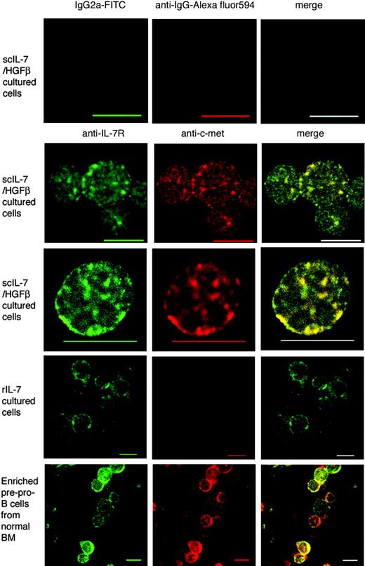Figure 5. Expression of the IL-7R and/or c-Met on culture-generated and normal pre-pro-B cells and pro-B cells. Images of IL-7R (green) and c-Met (red) examined by confocal microscopy show colocalization (yellow) patching and capping of IL-7R and c-Met on scIL-7/HGFβ culture-generated and enriched pre-pro-B cells from normal BM. IL-7 culture-generated cells expressed the IL-7R only. Some cytoplasmic staining is also seen in the latter cells, which were stained after the smears had been fixed. The top panels are isotype controls. Scale bars equal 10 μm.
