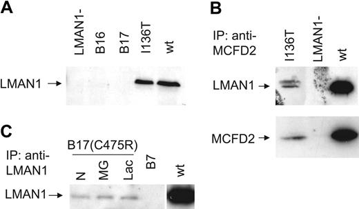 Figure 1. Immunoprecipitation and Western blot analysis of patient lymphoblasts. (A) Western blot analysis of LMAN1 in lymphoblasts from probands in families B16 and B17 compared with cells carrying the MCFD2 I136T mutation and wild-type (wt) cells. (B) A small amount of LMAN1-MCFD2 complex is detected in lymphoblasts with the MCFD2 I136T mutation. Lysates from 5 × 106 cells were immunoprecipitated (IP) with rabbit anti-MCFD2 followed by Western blot analysis with monoclonal anti-LMAN1 (top panel) or anti-MCFD2 antibodies (bottom panel). (C) Lymphoblasts from the B17 proband were untreated (N) or treated with the proteasome inhibitors MG132 (MG) or lactacystin (Lac) for 6 hours. Lysates from 5 × 106 cells of B17 and B7 lymphoblasts were immunoprecipitated with monoclonal anti-LMAN1 followed by Western blot analysis with polyclonal rabbit anti-LMAN1.