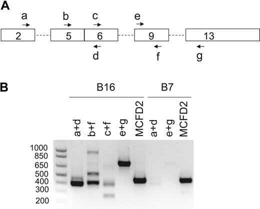 Figure 2. RT-PCR analysis of LMAN1 mRNA from probands of families B7 and B16. (A) Schematics of the LMAN1 cDNA with locations of PCR primers (Table 2, a-g) indicated. (B) Agarose gel electrophoresis of the RT-PCR products after amplification of LMAN1 mRNA with the various primer combinations indicated. The bottom bands in B16/b+f and B16/c+f lanes represent alternatively spliced species with exon 8 skipping, whereas the top bands represent the normally spliced products. The 900-bp band in the B16/b+f lane was a nonspecific PCR product according to sequence analysis. Two specific PCR products were observed in the B7/a+d lane. Sequencing of the latter PCR products further amplified by nested PCR revealed that the top band represents the normal spliced product, whereas the bottom band represents an alternatively spliced species with exon 4 skipping. Amplification of the coding region of MCFD2 mRNA served as a control for RNA quality.