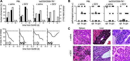 Figure 7. Ganciclovir administration rescues NOD/scid mice from severe GvHD induced by baCD3/CD28-TK+ human lymphocytes. At the time of severe GvHD, NOD/scid mice were treated with GCV or with saline. (A) Individual recipients of PBL (left graphs) or baCD3/CD28-TK+ lymphocytes (right graphs) were implanted subcutaneously either with a saline-filled or a GCV-releasing osmotic pump. At days 0, 7, and 14 from the implantation of the pumps mice were assessed for human chimerism by flow cytometry (▪) and scored for GvHD by a clinical index (□, top histograms). Mice were also followed for weight loss and mortality over time (bottom curves). Open arrows indicate saline; dashed arrows, GCV administration. The broken horizontal line is set at 95%. Results from one representative mouse per condition are shown. (B) Available mice infused with PBLs (left graphs) or with baCD3/CD28-TK+ lymphocytes (right graphs) and either treated with saline or with GCV were analyzed by histopathology and scored. GCV-rescued mice were humanely killed at the end of the study, 120 days after the infusion of baCD3/CD28-TK+ cells. Each symbol represents the spleen, gut, or liver score of individual animals. (C) Histologic sections from the spleen, liver, and gut of representative animals infused with baCD3/CD28-TK+ lymphocytes and treated either with saline (top row) or with GCV (bottom row) are reported.