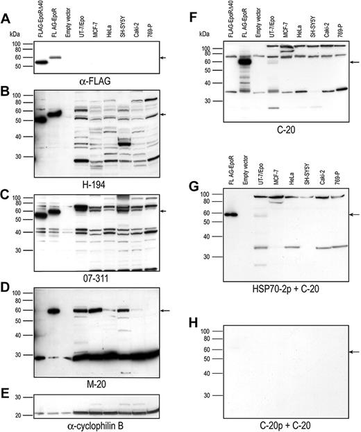Figure 1. Detection of EpoR with anti-EpoR antibodies. Protein extracts were prepared from tumor cell lines and COS-7 cells expressing FLAG-EpoR and subjected to Western immunoblotting. Each antibody was used to probe blots that had been processed simultaneously: (A) Anti-FLAG (M-2) antibody (1.8 μg/mL); (B) H-194 (0.03 μg/mL); (C) 07-311 (0.4 μg/mL); (D) M-20 (0.2 μg/mL); and (E) blot D was stripped and then reprobed with anti–cyclophilin B antibody (0.25 μg/mL) as a loading control; (F) C-20 (1.32 μg/mL); (G) C-20 preincubated with a 50-fold mass excess of HSP70-2 peptide (note absence of 66-kDa band); (H) C-20 preincubated with 10-fold mass excess of C-20p. The arrows indicate the position of the 59-kDa proteins. The positions of the molecular weight markers are illustrated on the left (kDa). FLAG-EpoR Δ40 protein was detected by the H-194 and 07-311 antibodies that recognize the extracellular domain and the N-terminal 15 amino acids, respectively, of EpoR.