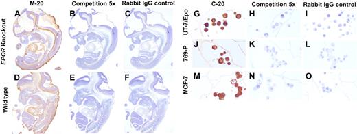 Figure 2. Lack of specificity of M-20 and C-20 antibodies when used for immunohistochemistry. To obtain EPOR-knockout (EPOR-/-) mouse embryos, timed matings were performed with heterozygous EPOR+/- mice.21 EPOR+/+ and EPOR-/- embryos (determined by yolk sac DNA polymerase chain reaction genotyping21) were recovered at day 12.5 for histology of the complete embryo and at day 13.5 for liver tissue. EPOR-/- embryos and EPOR+/+ embryos from wild-type littermates stained with M-20 (A,D). EPOR-/- and EPOR+/+ embryos stained with M-20 preincubated with a 5-fold excess of M-20 peptide (B,E). Rabbit IgG control antibody (C,F). UT-7/Epo, 769-P, and MCF-7 cell lines stained with C-20 (G,J,M). C-20 preincubated with a 5-fold excess of C-20p (H,K,N). Rabbit IgG control antibody (I,L,O).
