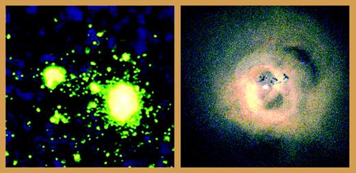 Areas of intense virion production in a lymph node were visualized by in situ hybridization autoradiography (left panel, from Zhang et al 6 ; copyright 2004 National Academy of Sciences, USA). Radiation from the black hole in Perseus was visualized by x-ray detection (right panel, Chandra X-Ray Observatory, NASA, by permission).
