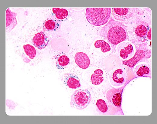 Peter Maslak, Memorial Sloan-Kettering Cancer Center