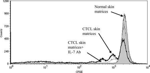 Figure 5. Proliferation of normal blood CLA-positive T cells incubated in matrices colonized with skin cells from CTCL lesions or normal skin. CFSE-labeled CLA-positive T cells were isolated from peripheral blood and incubated for 1 week in matrices colonized with skin cells from either CTCL or normal skin. T cells were analyzed by flow cytometry. CD3+ CLA+ CFSE+ lymphocytes divided up to 3 times in CTCL skin matrices (open histograms, bold line); this cellular division of T cells could be blocked significantly by addition of antibodies to IL-7 (open histograms, broken line). Normal skin matrices did not support cell proliferation (filled histograms).