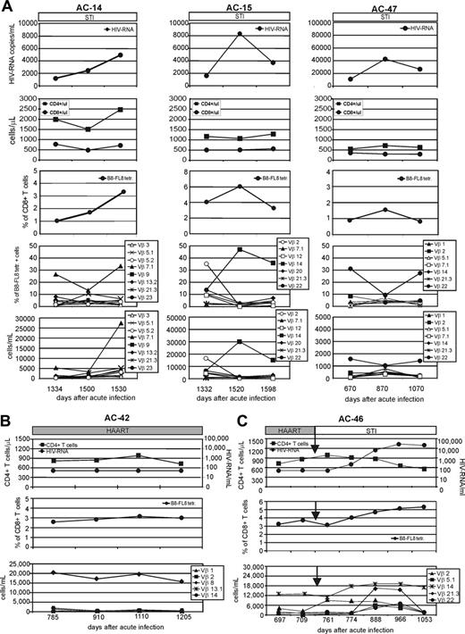 Figure 3. Longitudinal analysis of viral load, B8-FL8 tetramer expression, and B8-FL8–specific Vβ repertoire. (A) Longitudinal analysis of HIV-1 RNA copies per milliliter of plasma, absolute numbers of CD4+ and CD8+ T cells, percentage of B8-FL8 tetramer–positive cells per peripheral CD8+ T cells, as well as the relative and absolute number of B8-FL8–specific Vβ populations in 3 untreated HIV-infected individuals (AC-14, AC-15, and AC-47). Days indicate time after diagnosis of acute HIV infection. (B) Longitudinal analysis of HIV-1 RNA copies per milliliter of plasma, percentage of B8-FL8 tetramer–positive cells per peripheral CD8+ T cells, and absolute number of B8-FL8–specific Vβ populations for an HIV-infected patient (AC-42) under antiretroviral treatment. (C) Longitudinal analysis as in panel A for an HIV-infected patient (AC-46) undergoing STI after a phase of optimal viral suppression under antiretroviral treatment.