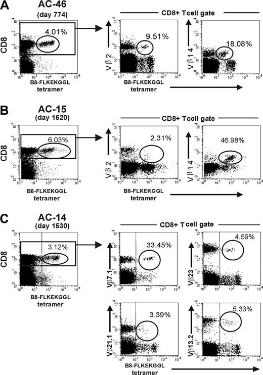Figure 4. Tetramer expression patterns of distinct Vβ populations. Frequency and staining patterns of B8-FL8 tetramer–positive CD8+ T cells in subjects AC-46 (A), AC-15 (B), and AC-14 (C). Percentages indicate the frequency of tetramer-positive cells per CD8+ T cells (left) or the frequency of Vβ+ cells within the B8-FL8 tetramer–positive population (middle and top).