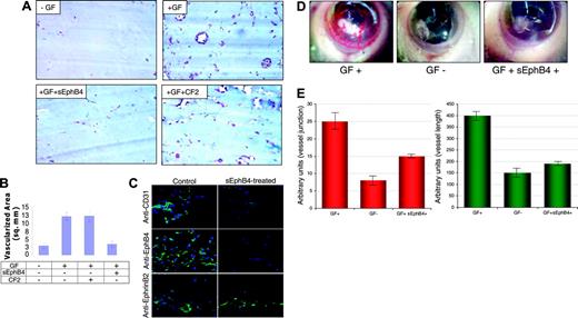 Figure 3. sEphB4 inhibits angiogenesis in murine Matrigel and corneal micropocket assays. (A) Matrigel solution was injected subcutaneously into Balb/C nu/nu mice. After 6 days, plugs were removed and processed in paraffin. Individual sections were stained with Masson trichrome and representative photographs at × 20 magnification from triplicate plugs in 2 independent experiments are shown. Top left shows section of a Matrigel plug without any added proteins; top right, section of plug containing VEGF only; bottom left, section of plug with sEphB4 and VEGF; and bottom right, section of plug with CF2 and VEGF. Photomicrographs were taken with a Nikon Coolpix 5000 camera on a Nikon Eclipse E400 microscope with a 4 ×/0.13 NA objective and a 10 × eyepiece. (B) Quantitation of vascularized area averaged (± SEM) from all plugs (Scion Image software). (C) Immunofluorescent staining of dissected plugs (with or without sEphB4) with PECAM, EphB4, and EphrinB2 antibodies. (D) sEphB4 was added to Hydron polymer and sucralfate with or without bFGF and inserted into a micropocket in corneas of Balb/C mice in triplicate. Shown is neovascular response on day 4 after implantation: Hydron with bFGF (left), with no growth factor added (center), and growth factor and sEphB4 (right). (E) Quantitation of vascularization averaged (± SEM) over all corneas in each group.