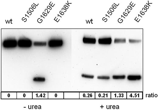 Figure 7. Quantitative analysis of ADAMTS13-mediated proteolysis of representative mutant and WT VWFA1-A2-A3 fragments. Ratios of the FLAG-tagged proteolytic fragment to the uncleaved substrate calculated from the areas under the curve were taken as proteolytic susceptibility.