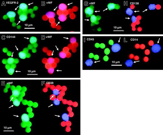 Figure 1. Immunophenotypic characterization of immunomagnetically sorted CECs by means of Dynabeads in MM patients with 13q14 deletion. In simultaneous double fluorescence staining experiments, CECs coexpress VEGFR-2 (positive green staining for anti-VEGFR-2 antibody) (A) and VWF (positive red staining for anti-VWF monoclonal antibody) (B), and CD144 (positive green staining for anti-CD144 monoclonal antibody) (C) and VWF (positive red staining for anti-VWF monoclonal antibody) (D). Immunomagnetically sorted CECs do not coexpress VWF (positive green staining for anti-VWF monoclonal antibody) (E,G) with plasma cell-associated markers CD38 (negative red staining for anti-CD38 monoclonal antibody) (F) and CD138 (negative red staining for anti-CD138 monoclonal antibody) (H). In patients with MM, immunomagnetically sorted CECs do not express CD45 (negative green staining for anti-CD45 monoclonal antibody) (I) and CD14 (negative red staining for anti-CD14 monoclonal antibody) (L). Note that several Dyna-beads are attached to the cells and that beads present red or green staining depending on the filter used for fluorescence analysis. White arrows indicate CECs: cell nuclei have been counterstained with DAPI II (blue staining). Scale bars equal 10 μm.