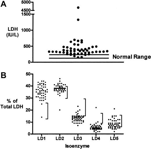 Figure 1. Serum LDH levels and isoenzyme distribution in patients with sickle cell disease. (A) Distribution of LDH levels on 50 occasions in 33 patients with sickle cell disease. Nearly all results are above the normal range (113-226 IU/L). (B) LDH isoenzyme fractionation of each sample suggests a tendency for the patient values to fall above the normal range (vertical bars to the right of each distribution) for LD1 and LD2 and below the normal range for LD3, LD4, and LD5 isoenzymes.