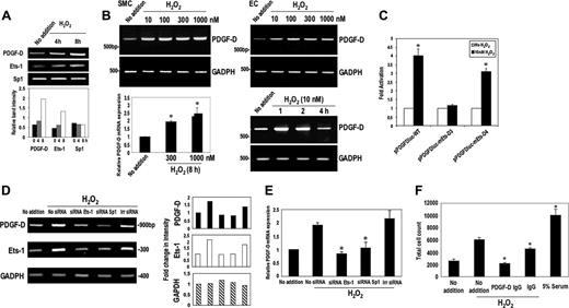 Figure 6. H2O2 activation of PDGF-D requires Ets-1. (A) H2O2 increases levels of PDGF-D and Ets-1, but not Sp1. SMCs were treated with H2O2 (10 nM) for 0, 4, and 8 hours prior to extraction of total RNA and assessment of PDGF-D, Ets-1, and Sp1 levels by RT-PCR. (B) H2O2 increases PDGF-D mRNA expression in SMCs and bovine aortic endothelial cells (ECs) at various concentrations (10-1000 nM) and in a time-dependent manner (10 nM) by RT-PCR. Real-time PCR (bottom left panel) confirms H2O2 induction of PDGF-D mRNA expression. (C) H2O2 stimulates PDGF-D promoter activity. SMCs were transfected with 10 μg wild-type p1168PDGF-Dluc, p1168PDGF-Dluc–bearing mutant Ets-D3 element, or D4 elements. H2O2 was added to a final concentration of 10 nM. Luciferase activity was determined after 24 hours. (D) Ets-1 and Sp1 siRNA block Ets-1 activation of PDGF-D expression. SMCs were treated with 0.2 μM Ets-1 siRNA, Sp1 siRNA, and irrelevant (Irr) siRNA overnight, then incubated with 10 nM H2O2 for 8 hours prior to extraction of total RNA and RT-PCR. The histograms on the right refer to band intensity in the blots on the left. (E) Assessment of PDGF-D mRNA expression by real-time PCR. SMCs were treated with 0.2 μM Ets-1 siRNA, Sp1 siRNA, and irrelevant siRNA overnight then incubated with 10 nM H2O2 for 8 hours prior to extraction of total RNA and real-time PCR. (F) SMCs were exposed to H2O2 (100 nM) in the absence or presence of goat polyclonal PDGF-D antibodies or goat IgG and total cell counts were determined after 3 days using a Coulter counter. Alternatively the cells were exposed to 5% serum for control purposes. The data are representative of at least 2 independent experiments. Error bars represent SEM performed in duplicate or triplicate. *P < .05 relative to control using Student t test.
