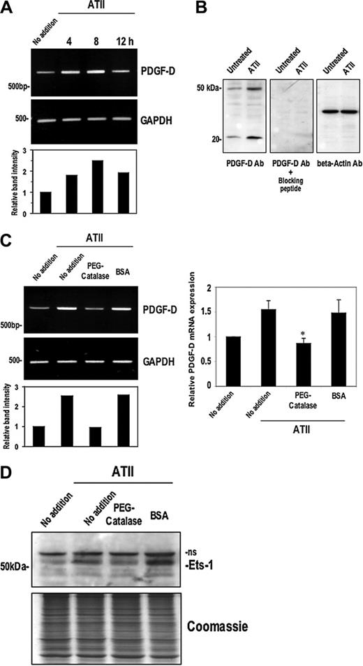 Figure 7. ATII induces Ets-1 and PDGF-D via H2O2. (A) SMCs were treated with 10– 7M ATII for the times indicated prior to extraction of total RNA and assessment of PDGF-D mRNA expression by RT-PCR. (B) SMCs were treated with 10–7M of ATII for 4 hours and then total cell lysates were assessed for PDGF-D protein expression by Western blotting. Peptide blockade experiments involved incubation of the PDGF-D antibody solution with or without the PDGF-D peptide (sc-23573P; 3.3 μg/mL final) for 1 hour at 37°C prior to incubation with filters. (C) PDGF-D mRNA expression by RT-PCR (left) or real-time PCR (right) in SMCs incubated with ATII for 4 hours and pretreatment with either PEG-catalase (50 U/mL) or the equivalent amount of bovine serum albumin (BSA) for 18 hours. (D) Ets-1 expression in SMCs incubated with ATII for 4 hours and pretreatment with either PEG-catalase (50 U/mL) or the equivalent amount of BSA for 18 hours; ns denotes nonspecific band. The data are representative of at least 2 independent experiments. Error bars represent SEM performed in duplicate or triplicate. *P < .05 relative to control using Student t test.