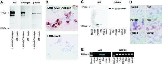 Figure 1. The monoclonal antibody C12.38 specifically recognizes AID. (A) Western blots of lysates from LMH cells transfected with a vector containing the coding sequence of AID and the SV40 T-antigen (LMH-AID/T-antigen) or mock vector (LMH-mock) were probed with mAb recognizing AID (clone C12.38), T-antigen, or β-actin as a loading control. Antibodies against AID and T-antigen both label a 47-kDa AID/T-antigen fusion protein in AID/T-antigen-transfected LMH cells, while mock-transfected cells are not reactive. (B) Cytospins of LMH cells transfected with AID/T-antigen, but not with mock vector stain with anti-AID. A nuclear staining detected in some LMH cells was probably nonspecific, since it was occasionally observed in tissues unlikely to express AID, such as epithelium. (C) Anti-AID mAb detects a 24-kDa band in Western blots from lysates of the human Burkitt lymphoma cell lines P3HR1and Raji, whereas Nalm6, Reh, HSB-2, and Jurkat lysates yield no signal. β-Actin probing was used as a loading control. (D) In cytospin preparations, P3HR1 and Raji cells stain with anti-AID. No labeling is seen with Nalm6, Reh, HSB-2, and Jurkat. (E) RT-PCR reveals AID expression in P3HR1 and Raji cells, but not in Nalm6, Reh, HSB-2, or Jurkat. All cell populations are strongly positive for the housekeeping gene GAPDH. Magnification: 40×/0.75 NA objective (B,D).
