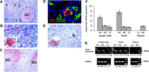 Figure 2. AID expression and class-switch recombination in secondary lymphoid organs and the thymus. AID expression was detected by conventional immunohistochemistry (A-C,E) and, in conjunction with CD20, by double immunofluorescent staining (D). AID is expressed in lymphoid follicles of the lymph node (A) and tonsil (C). In fully developed germinal centers (GCs), AID expression is predominately observed in the dark zone (C). Outside germinal centers, AID+ cells are found scattered throughout the T zone (A,C). The arrows in A indicate an extrafollicular area containing numerous AID+ cells. These AID-expressing cells are large and often display a distinct dendritic cytomorphology (B, and inset in B). Double staining of AID (red) and CD20 (green) shows coexpression of CD20 by AID+ cells (D). AID staining is largely limited to the cytoplasm (inset in B,D). Low numbers of AID+ cells are present in the thymic medulla (E) containing a Hassall corpuscle (arrow). AID+ asteroid cells of the thymic medulla morphologically resemble those in the T zone of the lymph node and tonsil (inset in E). (F) Quantification of AID mRNA by real-time PCR on microdissected tissue shows significant levels of AID expression in the germinal center, mantle zone (MZ), and T zone (TZ) of secondary lymphoid organs, and in the medulla (Me) of the thymus, but not in the thymic cortex (Co). Relative AID mRNA expression is given in arbitrary units as the mean (n = 3) and standard deviation. (G) Iγ-Cμ (1), Iα-Cμ (2), and Iα-Cγ (3) circle transcripts and GAPDH as a housekeeping gene were amplified by nested RT-PCR from microdissected tissue. Circle transcripts are detected in all 3 microcompartments of the lymph node and tonsil, and in the thymic medulla. No circle transcripts can be amplified from the cortical region of the thymus. Specific bands are indicated by arrowheads. The specificity of representative PCR products was confirmed by sequencing (GenBank accession nos. DQ083944-6). All data represent at least 2 independent stainings or measurements. Magnification: 10×/0.3 NA objective (A,C); 40×/0.75 NA objective (B); 63×/1.4 NA objective (D, and panels B and E's insets); and 20×/0.5 NA objective (E).
