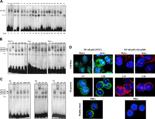 Figure 1. Constitutive NF-κB activation in CTCL cells. (A) CTCL cells constitutively express activated NF-κB. Nuclear extracts from CTCL cell lines (SeAx, HuT-78, MyLa) and from PBLs from 15 patients with Sézary syndrome were analyzed by EMSA. Analysis of SeAx (lane 1), HuT-78 (lane 3), and MyLa (lane 4) CTCL lines, and of PBLs from 15 patients with SS (lanes 5-19), and from one healthy donor as control (lane 20) is presented. N.S. represents a nonspecific unidentified band. Treatment with TNFα (10 ng/mL for 30 minutes) did not increase the constitutive nuclear translocation of NF-κB in SeAx cells (lane 2), and no translocation of NF-κB was detected in nuclear extracts of PBLs from a healthy donor (lane 20). The data shown are representative of 3 independent experiments. (B) Supershift assay of CTCL cell lines. Nuclear extracts from HuT-78, SeAx, and MyLa cells were subjected to supershift assays with specific NF-κB antibodies directed against p50, p65, p52, RelB, and c-Rel subunits. The positions of the retarded NF-κB species are indicated by arrows on the left. Similar results were obtained in 2 independent experiments. (C) Supershift assay of CTCL cells from 3 patients with Sézary syndrome. The assay was performed as described in panel B. (D) Evidence of NF-κB nuclear translocation in CTCL by confocal microscopic analysis. CTCL cells were fixed, permeabilized, and stained with DAPI (nucleus marker, blue); with anti-p65 (1/25); and visualized with anti–rabbit FITC–(green) or Texas Red (red)–labeled secondary Ab. Images were acquired on a Zeiss LSM-510 META laser scanning confocal microscope equipped with a Zeiss Plan Apochromat 63 ×/1.4 NA oil objective, using LSM510 software (version 3.2). Results obtained with CTCL cell lines SeAx and MyLa, PBLs from 2 patients with SS (cases 1 and 20), and from one healthy donor are presented. p50 and p65 proteins are detected in intranuclear and cytoplasmic localizations in CTCL cells only. The proportion of cells showing a positive nuclear staining reached 90% in CTCL lines and 80% in PBLs from SS patients. In contrast, resting PBLs from healthy donors exhibit a cytoplasmic pattern of p50/p65 staining.