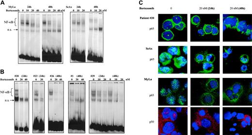 Figure 4. The proteasome inhibitor bortezomib inhibits the constitutive activation of NF-κB in CTCL cells in a dose- and time-dependent fashion. CTCL cell lines SeAx and MyLa (A) and CTCL cells from 5 patients with Sézary syndrome (B) were cultured in the presence of bortezomib (10, 20, and 40 nM) during 24 and 48 hours as indicated above each lane or group of lanes. Nuclear extracts were prepared and subjected to EMSA. The data are representative of 2 independent sets of experiments. (C) Confocal microscopy analysis. Confocal images of PBLs from one patient with Sézary syndrome (top panels), SeAx cells (middle panels), and MyLa cells (bottom panels) show the localization of p65 (green) and p50 (red) in untreated cells (left column), cells treated with 20 nM bortezomib for 24 (middle column) or 48 hours (right column). DAPI was used for nuclear staining. Images were acquired as described in Figure 1D.