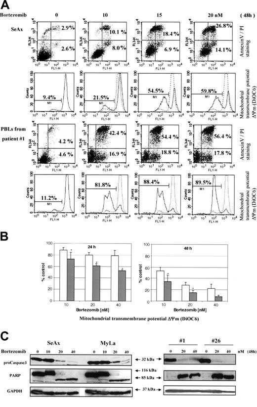 Figure 6. Bortezomib induces mitochondrial transmembrane potential loss, apoptosis, and caspase 3 activation in CTCL cells. SeAx, MyLa, and PBLs from patients with Sézary syndrome were treated with increasing concentrations (5-40 nM) of bortezomib for 24 to 48 hours. (A) Annexin-V binding was carried out with an Annexin V–FITC detection kit and measured by flow cytometry. Abscissa and vertical axis represent the fluorescent intensities of annexin V–FITC and PI, respectively. For each panel, the numbers in bottom right and top right quadrants indicate the percentages of annexin V+/PI– cells (apoptotic, viable cells) and annexin V+/PI+ cells (dead cells by apoptosis), respectively. The mitochondrial transmembrane potential Δψm was detected using the fluorescent probe DiOC6 by flow cytometry. The numbers indicate the percentages of cells exhibiting a decrease in Δψm. The overlaying ashed curve represents the control untreated cells. The results presented for SeAx cells (top panel) are representative of 1 of 6 independent experiments. Results obtained with PBLs from one patient with Sézary syndrome (bottom panel) are representative of data derived from 12 patients (panel B). (B) PBLs from 12 patients with Sézary syndrome and from 8 healthy donors were treated with increasing concentrations (10-40 nM) of bortezomib for 24 and 48 hours (left and right panels, respectively) and assayed for apoptosis by detection of Δψm alterations. The percentages of low Δψm cells were determined in duplicate and normalized using control untreated cells, which were arbitrarily set as 100. Results obtained with PBLs from healthy donors and from SS patients are represented by □ and ▪, respectively. Each value represents the mean ± SEM (n = 12 and n = 8, SS and healthy PBLs, respectively). *Statistically significant difference between healthy and SS PBLs. (C) CTCL cell lines (SeAx and MyLa) and PBLs from 2 patients with Sézary syndrome were treated with increasing doses of bortezomib (10-40 nM) for 48 hours. Cells were analyzed by Western blotting for expression of pro-caspase 3 (32 kDa) and PARP as an intact (116-kDa) or cleaved (85-kDa) protein. GAPDH signal was used as an internal control for loading. Data represent 1 of 2 independent experiments giving similar results.