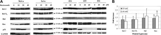 Figure 7. Bortezomib alters expression of Bax in CTCL cell lines and tumoral cells from patients with Sézary syndrome. SeAx cells, HuT-78 cells, and PBLs from patients with Sézary syndrome were treated with or without increasing concentrations of bortezomib (10-40 nM) for 48 hours. Expression of Bcl-2 family members was analyzed after Western blotting, using the indicated antibodies (Bcl-2, Bcl-xl, Bid Bax, and p53). The membrane was stripped and reprobed for expression of GAPDH to control for loading (A). The graph (B) shows the relative modifications of protein expression after 20 and 40 nM bortezomib, in comparison with control untreated cells, which were arbitrarily set as 1 (mean increase ± SD, n = 12). *Statistically significant increase as compared to untreated samples.