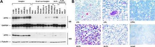 Figure 1. Hodgkin cell lines and primary HRS tumor cells are characterized by high constitutive ATF3 expression. (A) ATF3 mRNA and protein expression in Hodgkin and non-Hodgkin cell lines was determined by Northern (NB) analysis and Western (WB) blot analysis, respectively. As loading controls, GAPDH (glyceraldehyde-3-phosphate dehydrogenase) mRNA and α-tubulin protein expression were included. (B) Immunostaining for ATF3 in primary tissue samples (cHL, classical Hodgkin lymphoma; LPHL, lymphocyte-predominant Hodgkin lymphoma; ALCL, anaplastic large cell lymphoma).
