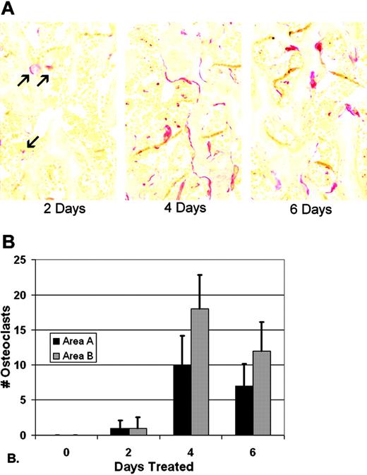 Figure 1. TRAP-positive osteoclasts in tl rats in response to CSF-1 injections. (A) TRAP staining of proximal tibial metaphysis reveals few osteoclasts by day 2 (red, arrows), and well-established populations at days 4 and 6 (images were obtained with a Zeiss Axioskop 2 Plus microscope with a 20 ×/0.5 NA brightfield objective). None were seen at day 0 (not shown). (B) Cell counts were performed in a window of defined size in 2 areas, area A near the chondro-osseous junction, and area B, in the lower metaphysis, in replicate slides of multiple animals (n = 24-36; bars show mean + 1 SD).
