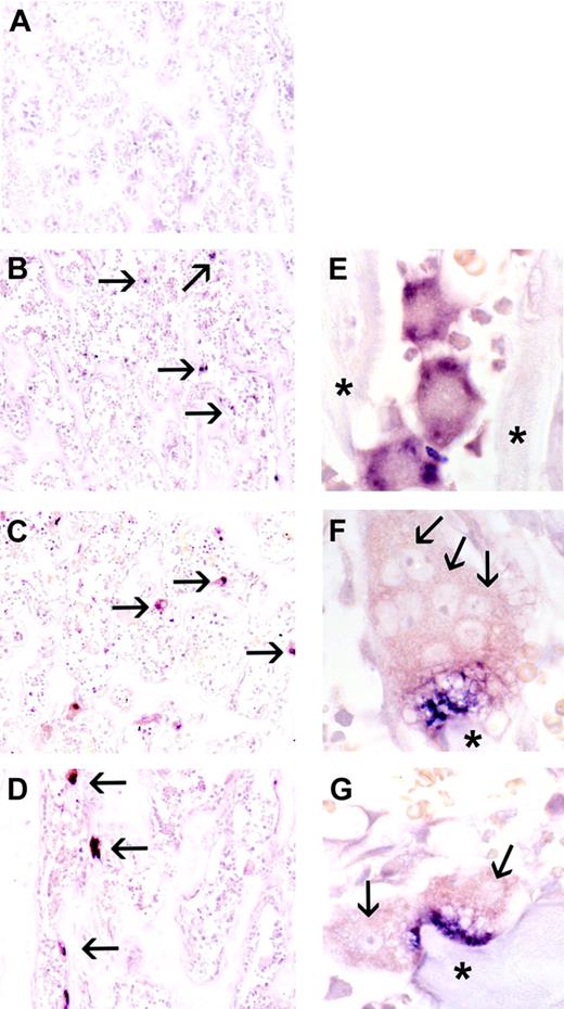 Figure 3. In situ hybridization for CCL-9 mRNA during CSF-1 time course, proximal tibia of tl rat. No CCL-9-expressing cells were visible at day 0 (A). CCL-9-positive cells are indicated in panels B-D with arrows. Many small cells were detected at day 2 (B,E), and larger osteoclasts were seen at days 4 (C,F) and 6 (D,G). Higher magnification revealed cytological features of the CCL-9-expressing cells. Arrows in panels F and G indicate some individual nuclei. The cells seen at day 2 were typically smaller, mononuclear, and less differentiated, while at days 4 and 6, osteoclasts generally contained multiple nuclei and were better differentiated. The CCL-9 mRNA is diffusely distributed throughout the cytoplasm in the differentiating mononuclear pre-osteoclasts in panel E, but appears highly concentrated in the ruffled border area in days 4 (F) and 6 (G). *Bone trabeculae. Original magnifications: × 100 (A-D); × 630 (E-G). No counterstain was used.