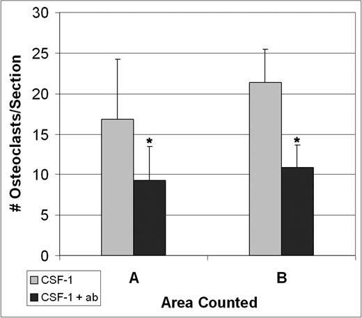 Figure 6. Injections of anti-CCL9 suppress osteoclast differentiation in vivo. tl/tl rats were injected either with CSF-1 alone or with anti-CCL9 antibody and CSF-1, and TRAP+ osteoclasts were counted on multiple sections of the proximal femur from 3 animals for each condition after 4 days of injections. Anti-CCL9 significantly reduced the osteoclastogenic response to CSF-1 injections. Means + 1 SD are shown. In both areas, differences were highly significant (*P < .001).