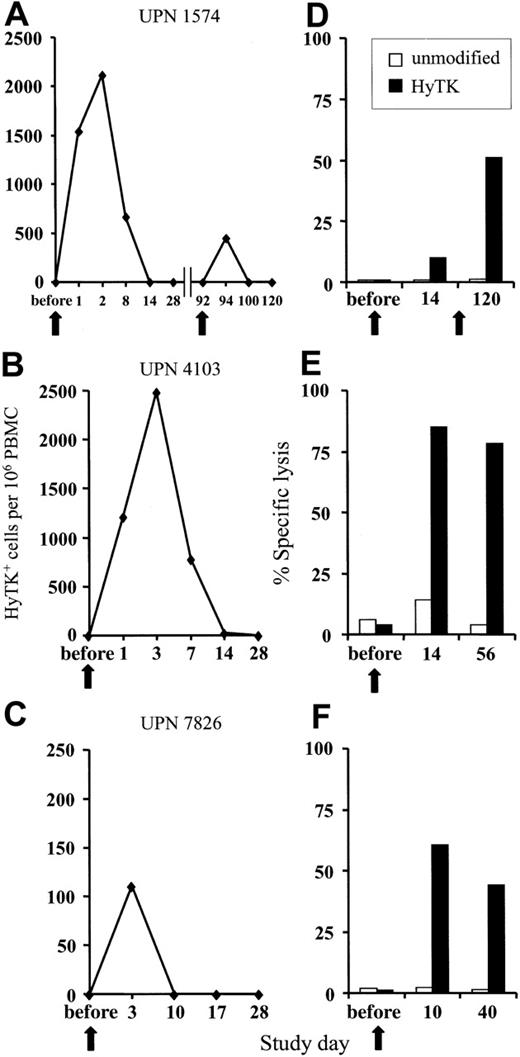 Figure 1. Adoptively transferred HyTK-modified T cells. (A-C) Persistence of adoptively transferred HyTK-modified T cells in vivo. PBMCs from each of the 3 patients were obtained at various time points before and after infusion of HyTK-positive T cells and evaluated for the presence of HyTK-transduced cells by quantitative PCR as described in “Patients, materials, and methods.” (D-F) Rapid induction of a HyTK-specific CTL response after adoptive transfer of HyTK-modified T cells. PBMCs from each of the 3 patients were obtained prior to and at various times after infusion and stimulated in vitro with γ-irradiated HyTK-positive donor T cells. Aliquots of these cultures were then evaluated in a chromium release assay for recognition of HyTK-positive target cells (▪) or unmodified controls (□). The killing of HyTK-positive LCLs is shown at an effector-target ratio of 10:1. The arrows indicate the day of the HyTK-positive T-cell infusion.