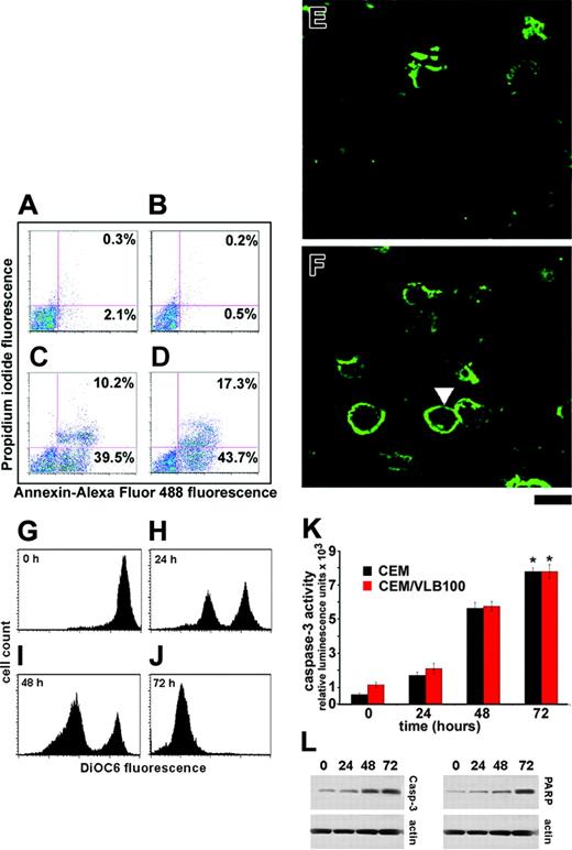 Figure 2. EM011 induces apoptosis. Panels A-D show flow cytometric analysis of phosphatidylserine (PS) exposure in untreated CEM (A), untreated CEM/VLB100 (B), EM011-treated CEM (C), and EM011-treated CEM/VLB100 (D) cells. Alexa-Fluor 488 conjugate of annexin V was used in combination with PI to distinguish among 3 subpopulations: PI- and Alexa-Fluor 488- population indicates viable cells (bottom left quadrant); PI- and Alexa-Fluor 488+ population indicates early apoptotic cells (lower right quadrant); PI+ and Alexa-Fluor 488+ population indicates late apoptotic cells (top right quadrant). Representative annexin V-stained cells are shown in panel F (EM011-treated) as green rings surrounding early apoptotic cells (solid arrowhead) as opposed to the control untreated cells in panel E, where green rings are absent. However, some nonspecific staining is evident. Scale bar = 20 μm. (G-J) EM011 reduces mitochondrial transmembrane potential in a time-dependent manner. CEM/VLB100 cells were treated with EM011 for 0, 24, 48, and 72 hours, incubated with 50 nM DiOC6, and then analyzed by flow cytometry. The x-axis represents the DiOC6 fluorescence intensity, and the y-axis represents the number of cells. (K) Quantitation of caspase-3 activity in EM011-treated CEM and CEM/VLB100 cells. Cells were treated with 10 μM EM011 for 0, 24, 48, and 72 hours, and caspase-3 activity was analyzed using the luminogenic substrate Z-DEVD-aminoluciferin. *P < .01. (L) Representative immunoblot of cleaved caspase-3 and cleaved PARP along with the loading control, actin. Results are representative of 3 independent experiments performed.