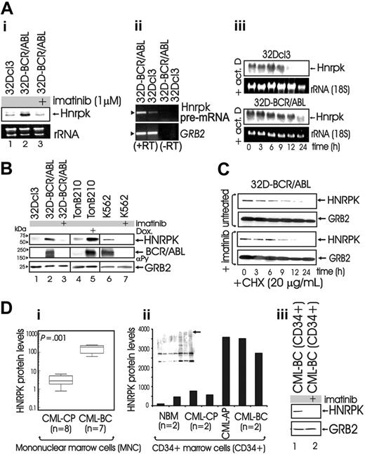 Figure 1. Effect of BCR/ABL on HNRPK mRNA and protein expression. (Ai) Northern blot shows expression of Hnrpk mRNA in parental, untreated, and imatinib-treated BCR/ABL-expressing myeloid progenitor 32Dcl3 cells. (Aii) RT-PCR on nuclear RNA shows levels of Hnrpk pre-mRNA in parental and BCR/ABL-expressing myeloid progenitor 32Dcl3 cells (+RT). The amplified PCR product is comprehensive of part of exon 2, intron 2, and part of exon 3 of the mouse Hnrpk gene.-RT indicates that PCR was performed on non-reverse-transcribed nuclear RNA. GRB2 mRNA levels were measured as control. (Aiii) Effect of actinomycin D on Hnrpk mRNA levels in parental and BCR/ABL-expressing 32Dcl3 cells. Cells were incubated for the indicated time with actinomycin D used at a concentration (5 μg/mL) that reportedly inhibits RNA polII-dependent transcription. (Bi) Western blots show HNRPK protein levels in parental 32Dcl3 cells (lane 1) and in untreated (lane 2) and imatinib-treated (lane 3) 32D-BCR/ABL cells, in BCR/ABL-induced (doxycycline 1 mg/mL, 24 hours) TonB210.1 lymphoid progenitors (lanes 4-5), and in untreated and imatinib-treated Ph1 K562 cells (lanes 6-7). (C) HNRPK protein stability was determined by anti-HNRPK Western blots in untreated and imatinib-treated 32D-BCR/ABL cells exposed to the protein synthesis inhibitor cycloheximide (CHX). GRB2 levels were monitored as control for equal loading. (Di) Plot shows HNRPK protein levels expressed as log of arbitrary densitometric units after normalization with GRB2 levels in mononuclear cells from CML patients in the chronic (CML-CP) and blast crisis (CML-BC) phases. (P = .001; Wicoxon rank sum test). (Dii) Graphs shows GRB2-normalized HNRPK protein levels expressed as densitometric units in the CD34+ fraction of bone marrow from 2 healthy donors (NBM), and 2 CML-CP, 1 CML-AP, and 2 CML-BC patients. The Western blot in the inset shows total tyrosine phosphorylation, and the arrow indicates levels of active BCR/ABL. (Diii) HNRPK protein expression in untreated and imatinib-treated CD34+ CML-BC patient marrow cells. GRB2 was used as control for equal loading.