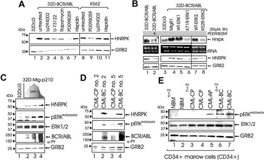 Figure 2. Role of MAPK in the regulation of HNRPK expression in BCR/ABL+ cells. (A) Effect of different chemical inhibitors of known BCR/ABL-activated pathways on HNRPK protein levels in 32D-BCR/ABL and K562 cells. (B) Effect of the MEK1/MAPK inhibitor PD098059 (lane 2) on Hnrpk mRNA (first row) and protein (third row) expression. Hnrpk mRNA (first row) and protein (third row) levels in parental 32Dcl3 cells (lane 3), vector-transduced 32D-BCR/ABL (lane 4), and 32D-BCR/ABL cells ectopically expressing wild-type MAPK ERK1 (lane 5), the K71R dominant-negative MAPK ERK1 mutant (lane 6), wild-type ERK2 (lane 7), and dominant-negative K52R ERK2 mutant (lane 8). rRNA and GRB2 are shown as controls for equal loading. (C) Effect of BCR/ABL tyrosine kinase on MAPK/ERK activity. pERK1/2 indicates phosphorylated (active) ERK1 and ERK2 mitogen-activated protein kinases. Western blots show levels of HNRPK, phospho-ERK1/2, total ERK1/2, BCR/ABL, and GRB2 in 32Dcl3 myeloid precursors transduced with a GFP/BCR/ABL bicistronic retrovirus and sorted for low, medium, and high GFP levels. (D) Levels of HNRPK, phospho-ERK1/2, BCR/ABL, and GRB2 in mononuclear marrow cells from paired chronic phase (CP) and blast crisis (BC) CML patient samples. (E) Levels of pERK1/2, ERK1/2, and GRB2 in NBMCD34+, CML-CPCD34+, CML-APCD34+, and CML-BCCD34+samples.