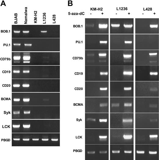 Figure 1. Reactivation of the B-lineage genes in cHL-derived cell lines by treatment with 5-aza-dC. (A) Silencing of B-cell-specific genes in cHL cell lines. Transcriptional activity of B-lineage-specific genes was assayed by RT-PCR in Burkitt lymphoma (Namalwa and BJAB) and cHL (KM-H2, L1236 and L428) cell lines. (B) Reactivation of genes by 5-aza-dC treatment. 5 × 106 cells were seeded in complete medium at a density of 0.2 × 106 cells/mL. The next day, cells were treated with 1 μM 5-aza-dC for 24 hours. Then, cells were washed and resuspended in the fresh medium. After 72 hours cells were harvested and gene expression was assessed by RT-PCR. Whereas 35 PCR cycles were performed for most genes, signals for CD20, BCMA, and SYK could be detected only after 40 cycles in L428 cells. Cycles of amplification (25) were used for PBGD. PCR products were separated on the 1.5% agarose gel and visualized by EtBr staining. All experiments were done at least in triplicate.