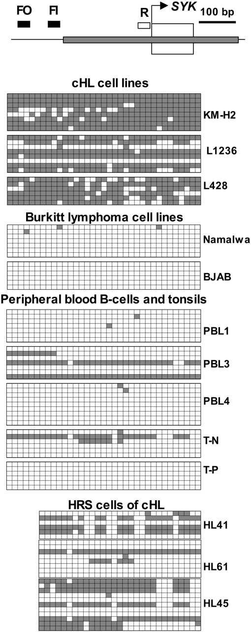Figure 5. SYK is methylated in cHL cell lines and in HRS cells of primary cHL. The methylation status of the SYK promoter was analyzed by genomic sequencing. The bisulfite-treated genomic DNA was amplified with seminested primers as indicated: FO indicates forward outer primer; FI, forward inner primer; and R, reverse primer. For amplification of DNA from cell lines and normal tissues only FO and R primers were needed (since there was enough material). The obtained amplicon contained 35 CpG dinucleotides. The first and last CpGs were located at positions -294 and -23, respectively, counting from the start site of transcription (bent arrow, predicted by Entrez Gene, NCBI). Samples of 50 to 100 microdissected HRS cells were reamplified with seminested primers FI and R. This amplicon included 29 CpGs; the first CpG was at the position -228. The gray bar represents the CpG island. The first exon is depicted as an open box. The PCR products were cloned into the pCAPsvector and sequenced. Peripheral B lymphocytes (PBLs) PBL1, PBL3, and PBL4 were isolated from the blood of healthy donors. HRS cells were isolated from primary cHL biopsies (HL41, HL61, and HL45) by laser capture microdissection. Clones (5 to 11) were sequenced from each sample. Every row represents a single PCR clone. □ indicates unmethylated CpG dinucleotides; ▪, methylated CpGs.