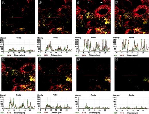 Figure 6. Sequential imaging of HUVECs immunostained for P-selectin and VWF. Shown starting at the apical surface (A-H) and extending to the basal surface imaged every 0.5 μm are z-sections of merged images depicting colocalization of VWF and P-selectin. Histograms were generated using the profile feature in the Zeiss LSM image browser and represent the colocalization of P-selectin and VWF when graphed objectively through the red line. Note that when certain granules appear to be composed of entirely P-selectin (green) and when examined objectively, there is underlying VWF (red). Examination of at least 6 to 8 additional fields yielded similar results. Images were obtained by viewing through a × 63 objective.
